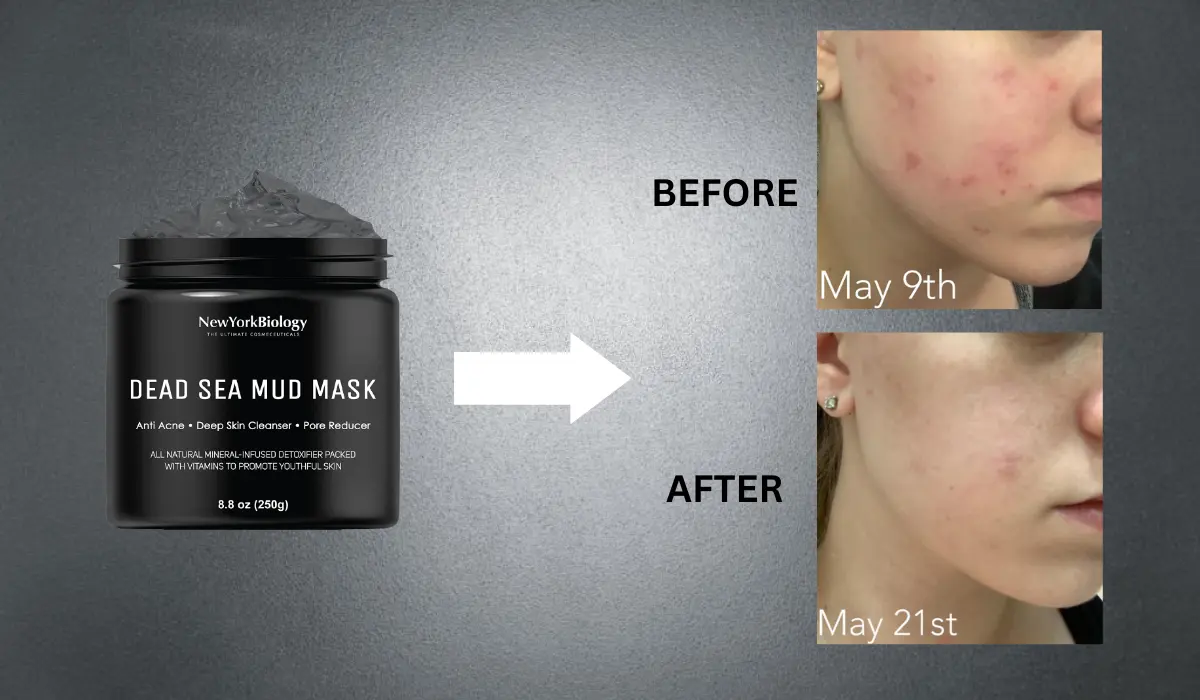 Dead Sea Mud Mask Results