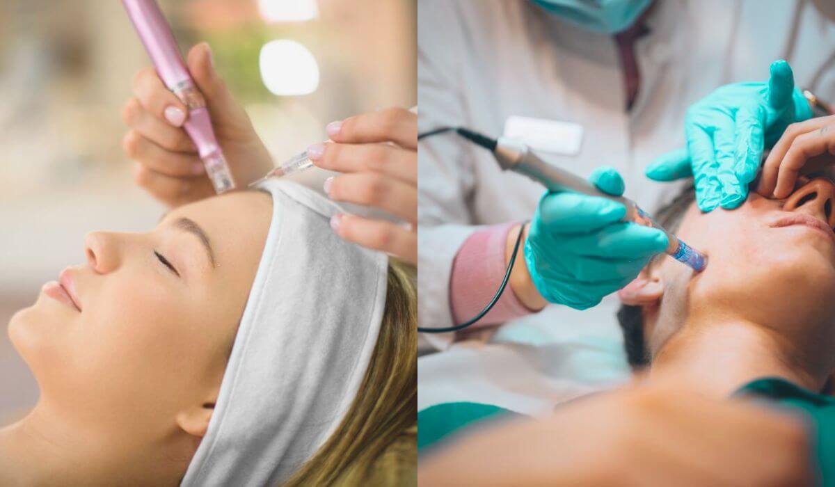 Key Points To Know About Collagen Induction Therapy