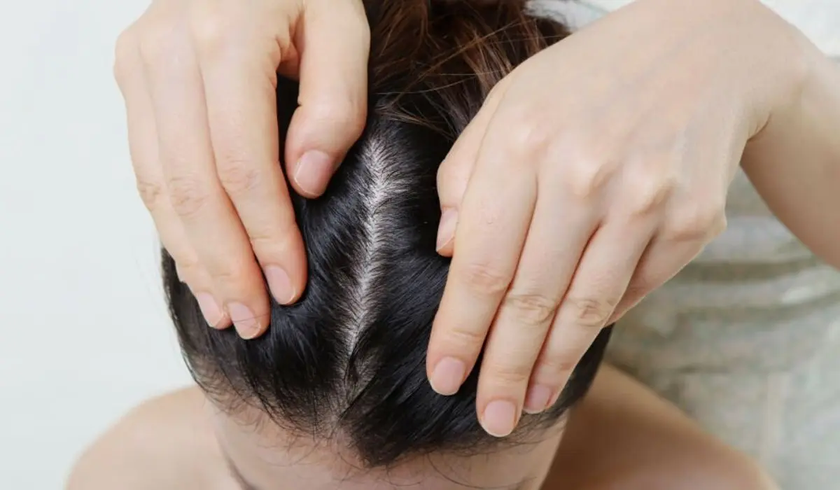 Normal Scalp