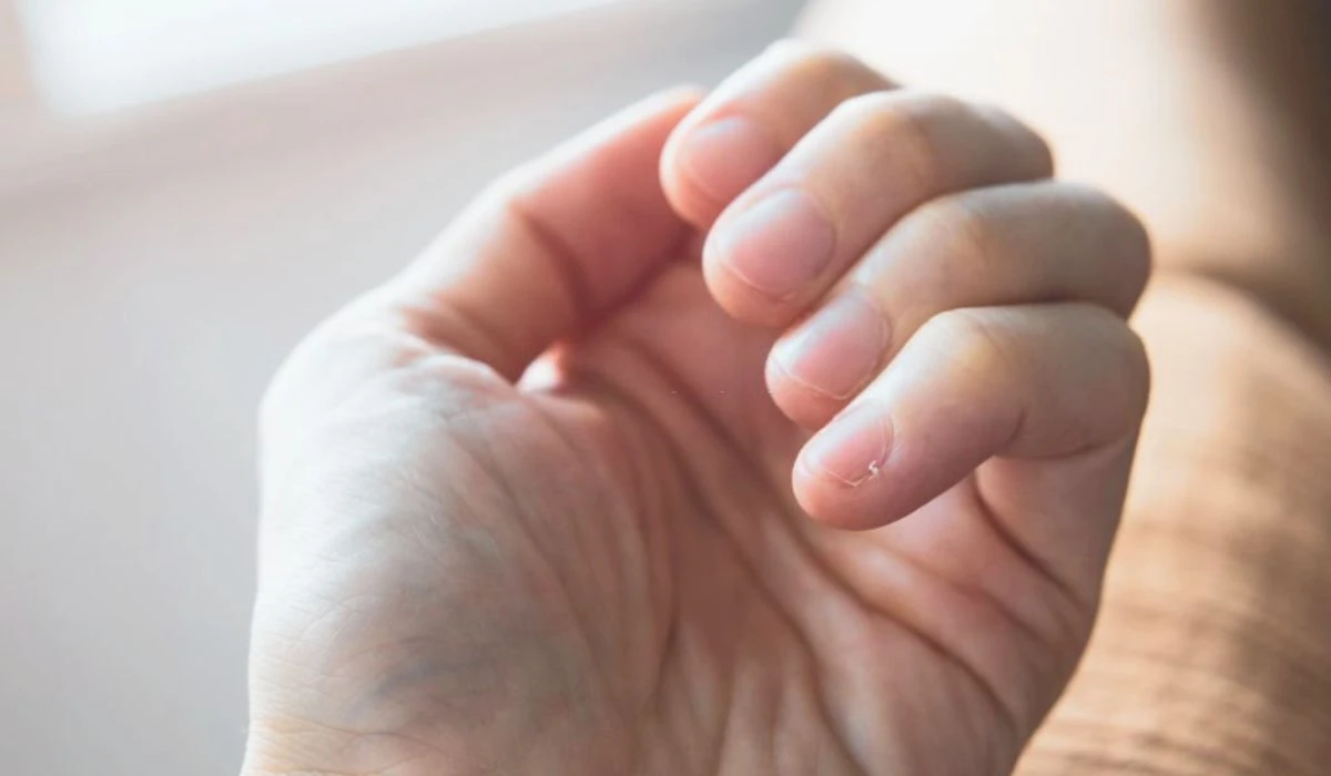Causes Of Fingernail Pain