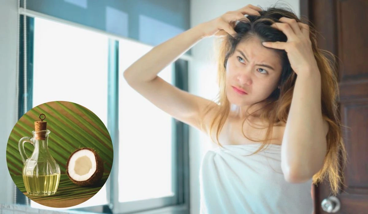 How To Use Coconut Oil For Dandruff Usage, Benefits, And Precautions