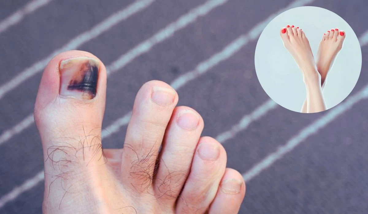 Here's What the Color of Your Toenails Mean