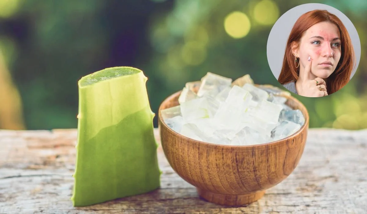 Usage Of Aloe Vera To Reduce Skin Redness