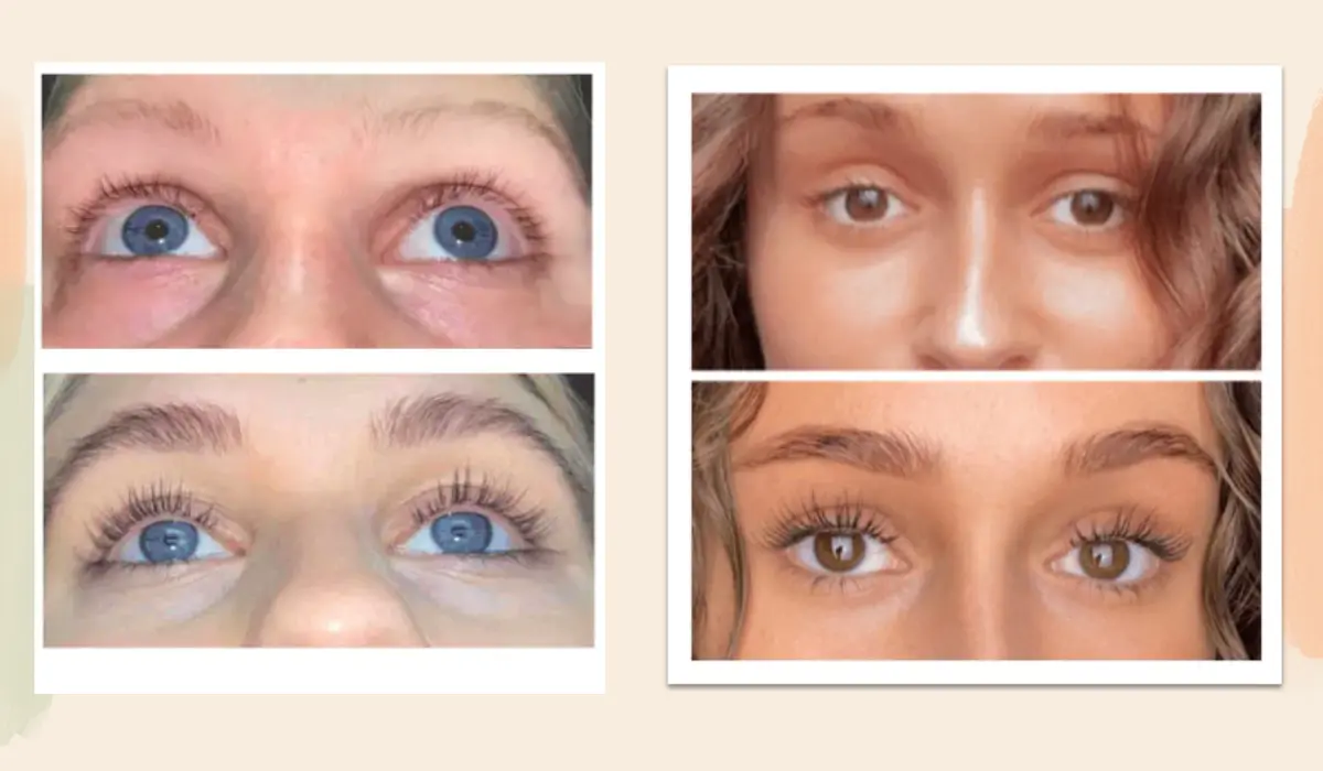 Forever Brow Serum Before and After