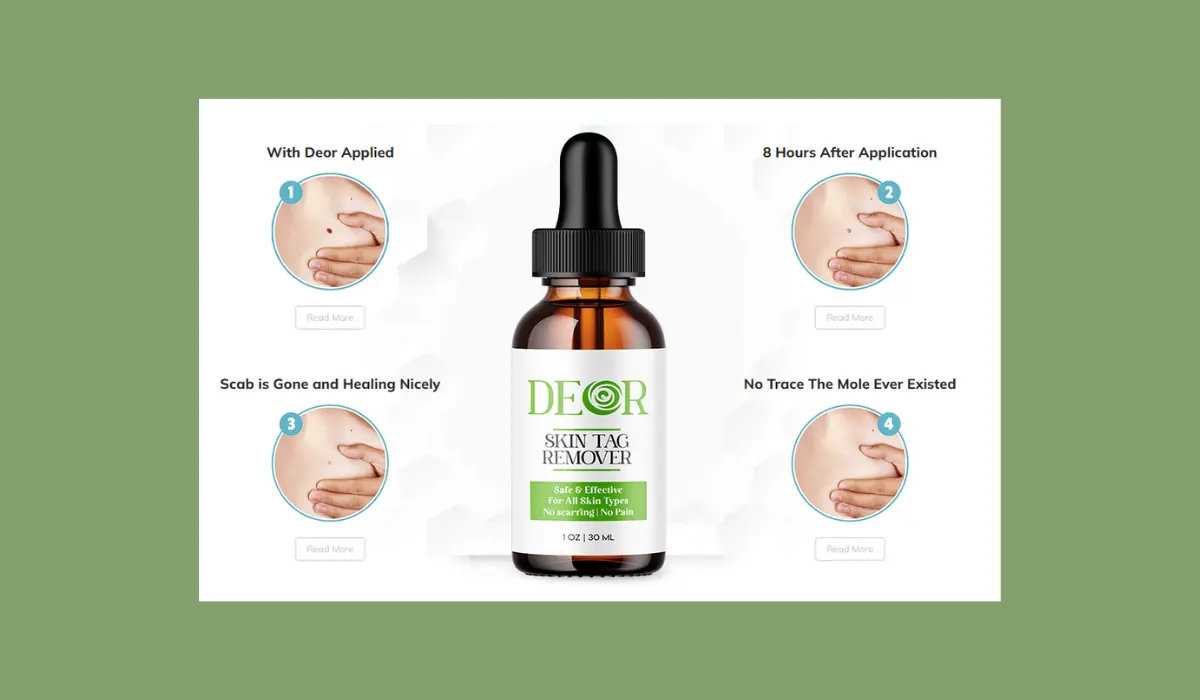 Deor Skin Tag Remover Working
