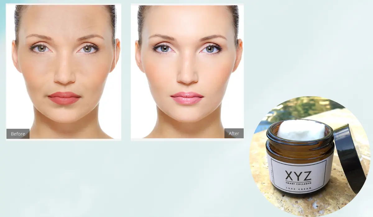 XYZ Smart Collagen Results