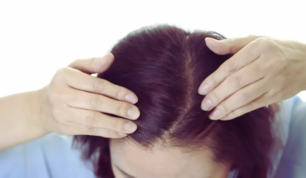 Calcium Deficiency Affect Hair Loss