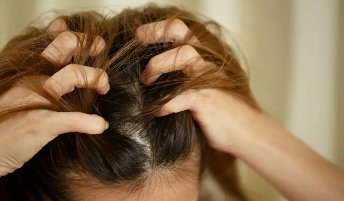 Causes Of Dry Scalp