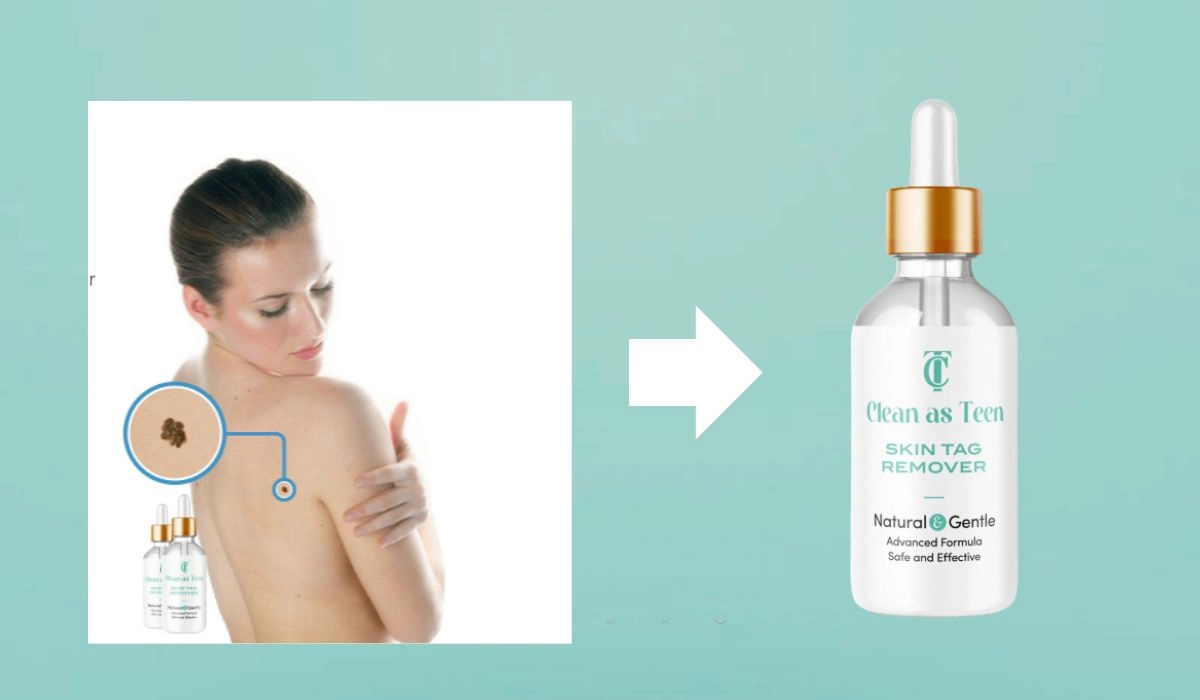 Clean As Teen Skin Tag Remover Usage