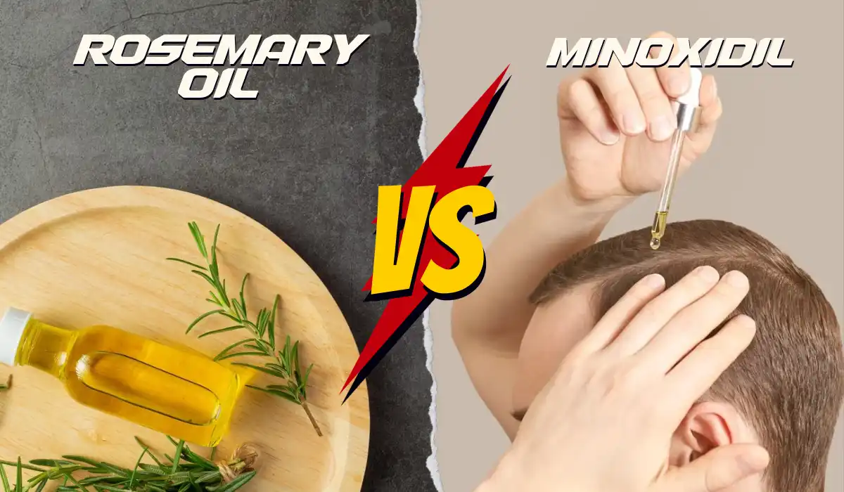 Rosemary Oil Vs Minoxidil