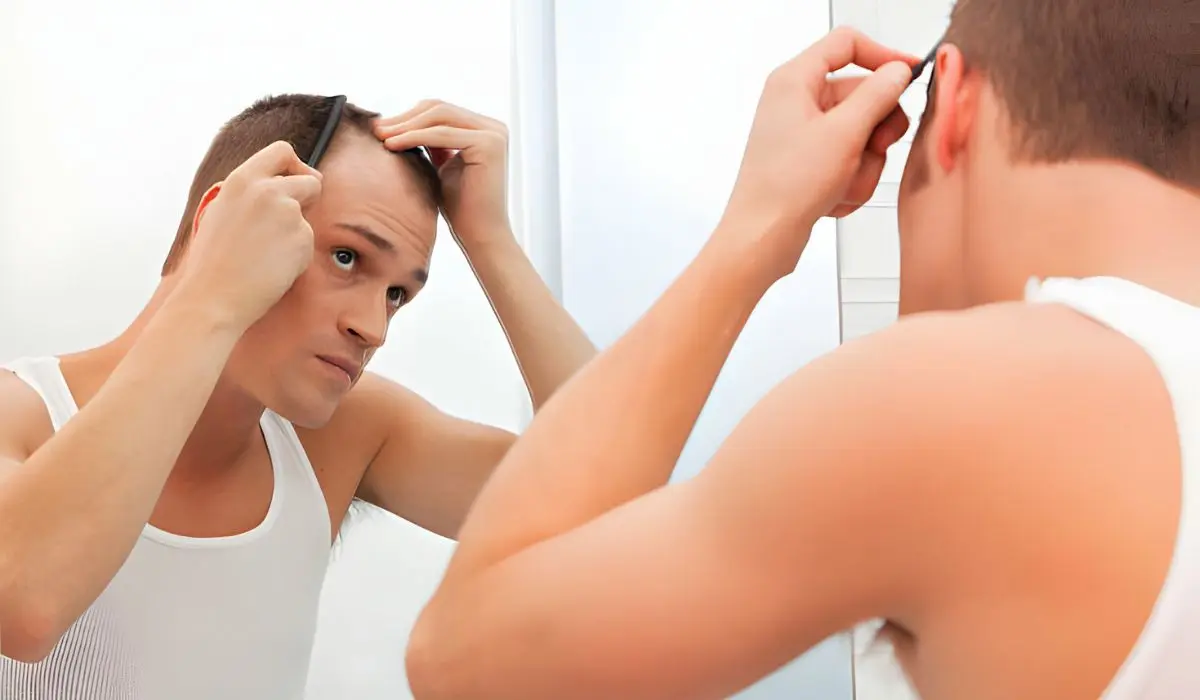 Early Signs Your Hairline Is Receding