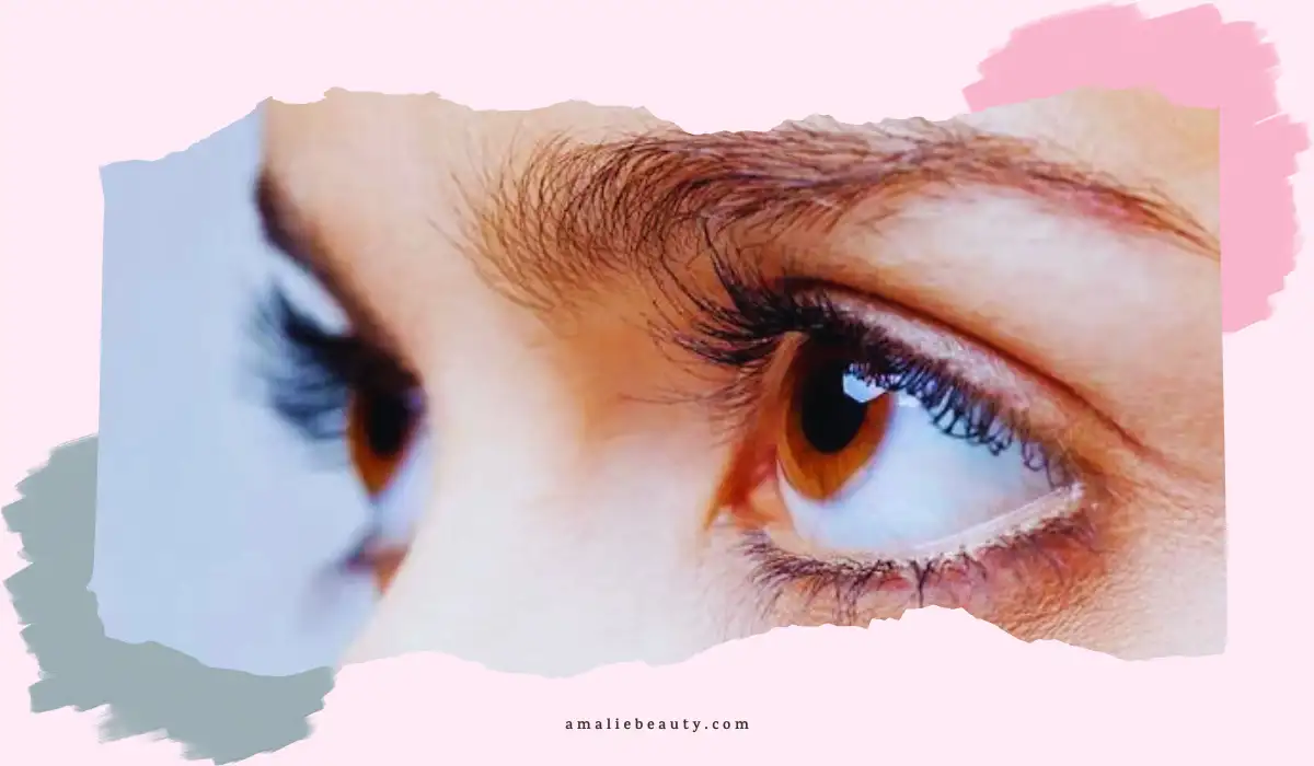 Melanoma Of The Eyelid