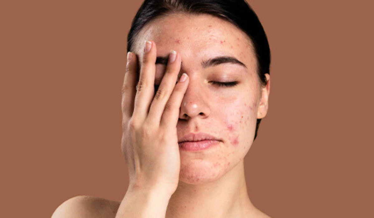 Reduce skin irritation