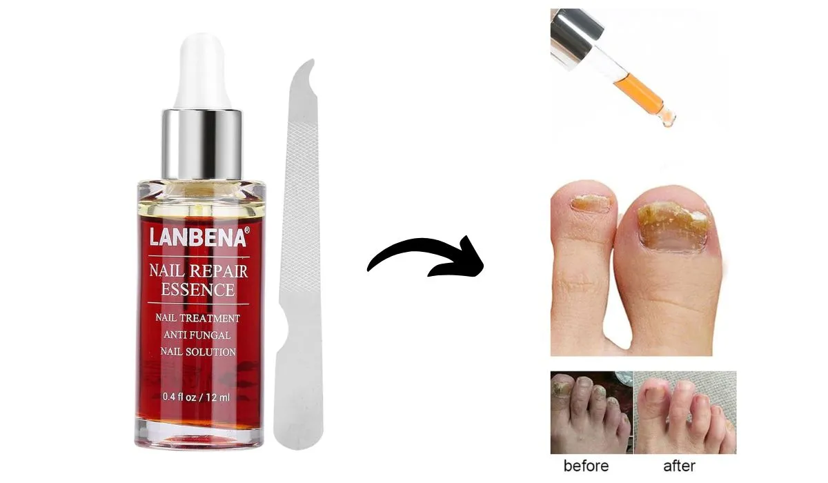 Nail Repair Essence Before and after Images